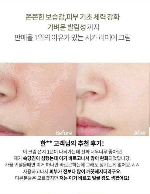 آمپول هیالورونیک سیکا برند دکتر ای جی