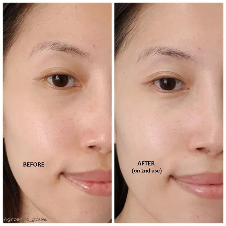 ☁️ست ماسک دوتایی Mask Now Glow Later اکسیس-وای
