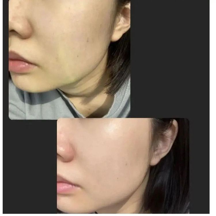 کرم مرطوب کننده ی متعادل کننده ی ph پوست نیدلی