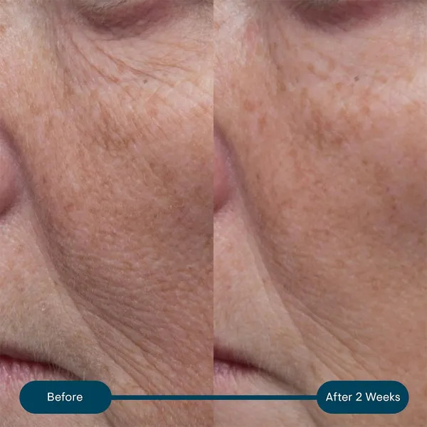 کرم المیس پروکلاژن حاوی spf